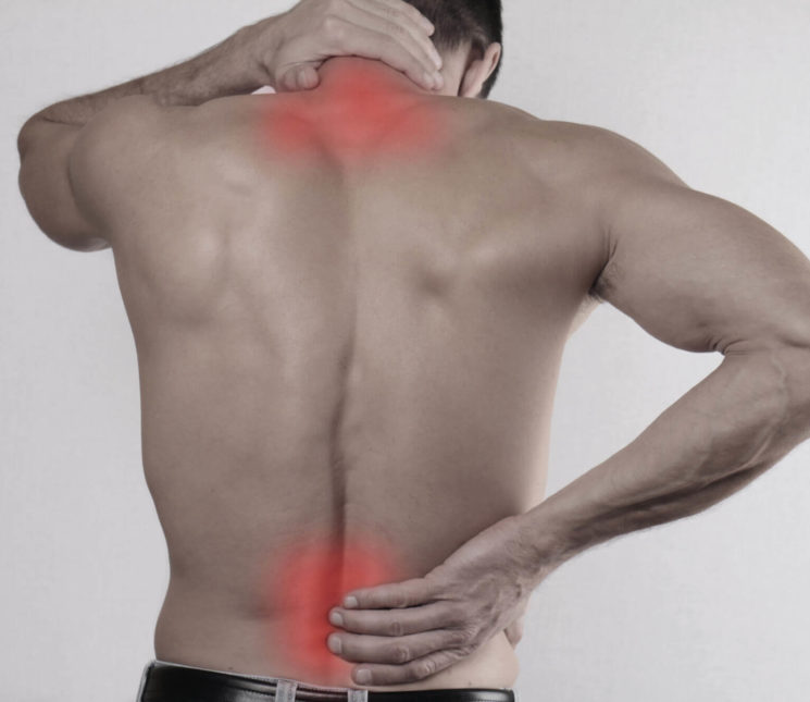 latigazo cervical tratamiento fisioterapia