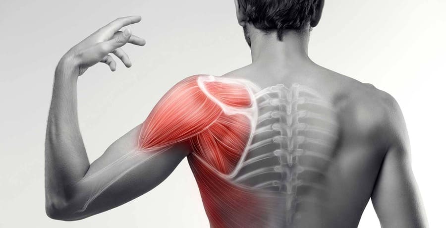 Tendones del hombro - cuales son, dolor, inflamación